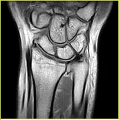 MRI Image